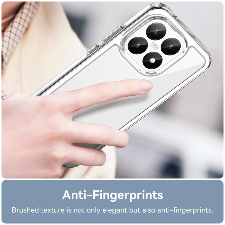 For Xiaomi 15T 5G WANLONFENG Electroplated Buttons TPU Acrylic Phone Case with Screen Protector
