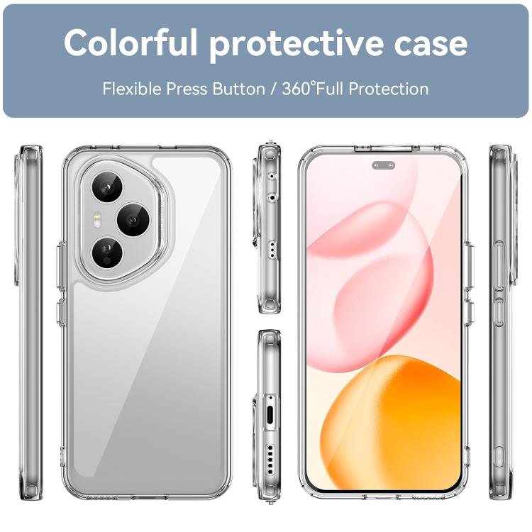 For Honor 400 Pro Global 160.8mm WANLONFENG Electroplated Buttons TPU Acrylic Phone Case with Screen Protector