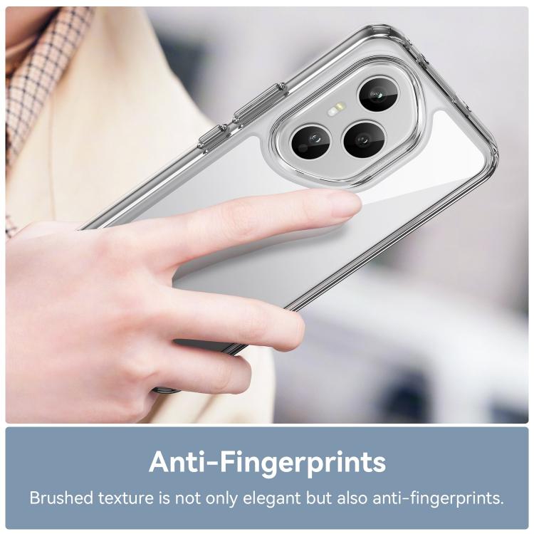 For Honor 400 Pro Global 160.8mm WANLONFENG Electroplated Buttons TPU Acrylic Phone Case with Screen Protector