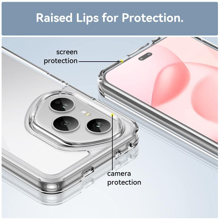 For Honor 400 Pro Global 160.8mm WANLONFENG Electroplated Buttons TPU Acrylic Phone Case with Screen Protector