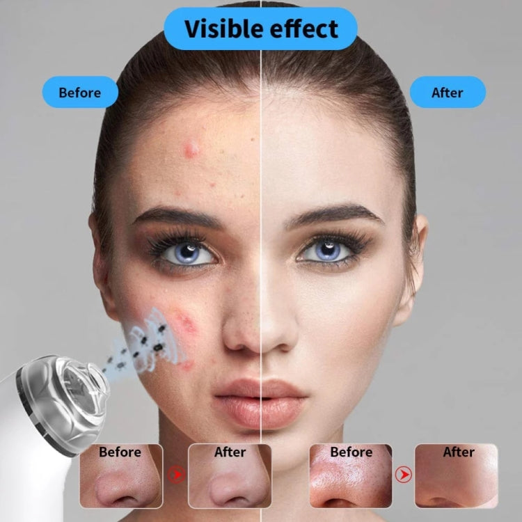 505 Household Electric Acne Blackhead Meter Export Instrument Pore Cleaner