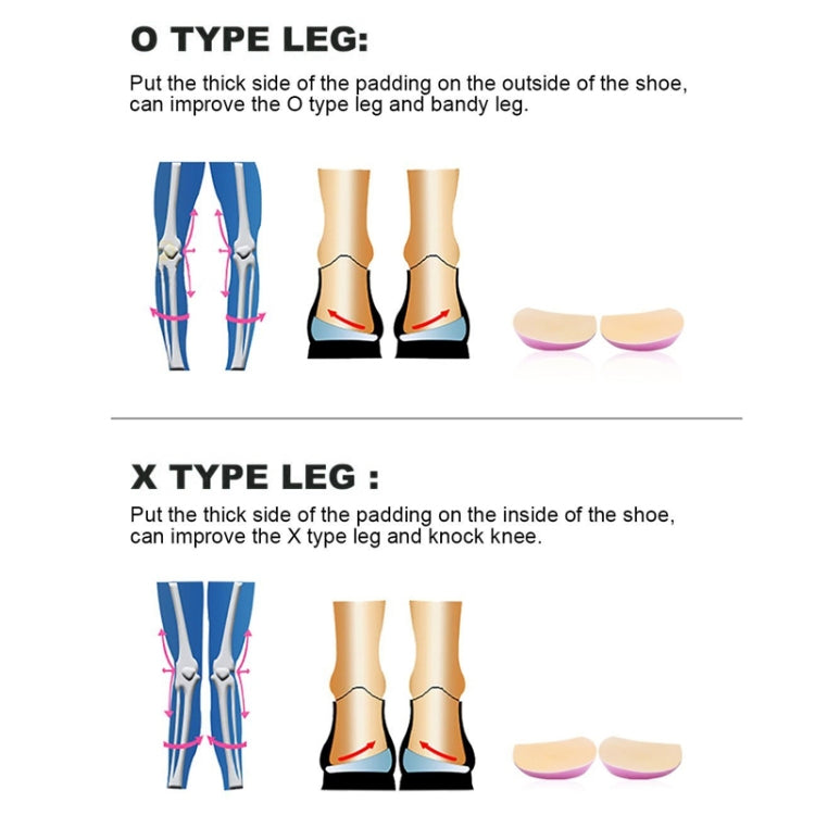 5 Pair Upgraded Version of Men And Women O / X Leg Correction Insole Inside / Outside Eight Feet Orthopedic Correction Heel Pad