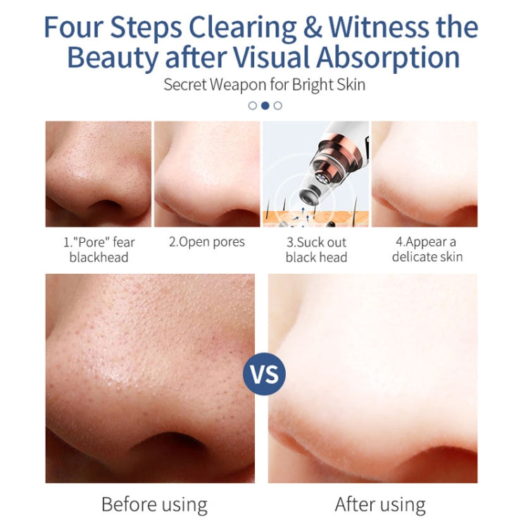 GH-HT1 2MP Visual Blackhead Beauty Instrument with Four Modes & WiFi