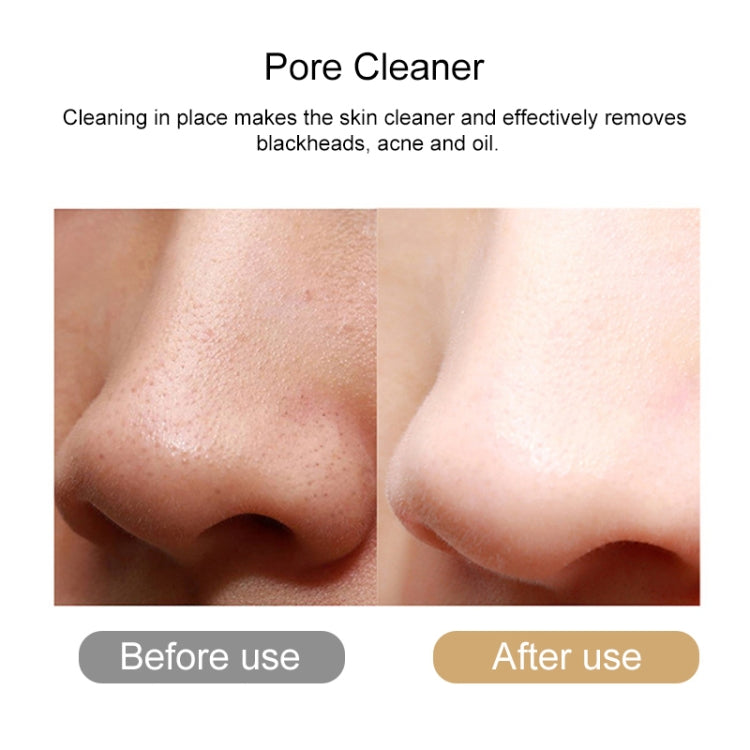 Ultrasonic Deep Face Cleaning Machine Skin Scrubber Remove Dirt Blackhead Facial Beauty Instrument