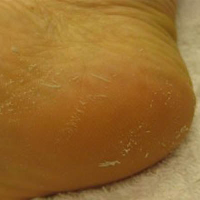 Foot Setback, to Cocoon Polished Dedicated(Baby Blue)