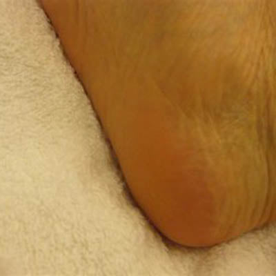 Foot Setback, to Cocoon Polished Dedicated(Baby Blue)