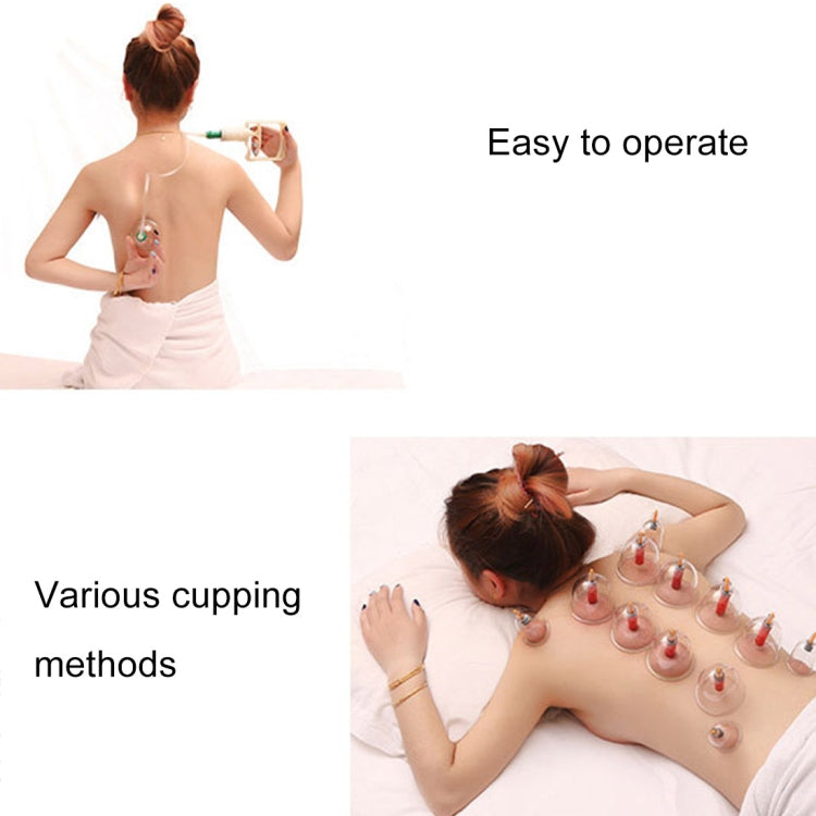 12-Cup Cupping Device Set Versatile Traditional China Cupping Therapy Device(Beige)