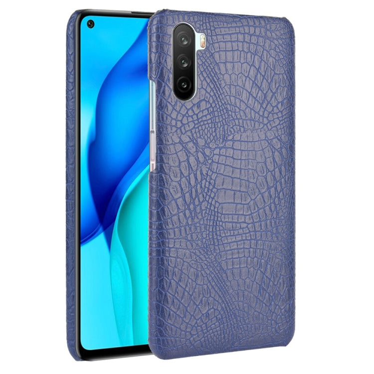 For Huawei Mate 40 Lite/Maimang 9 Shockproof Crocodile Texture PC + PU Case