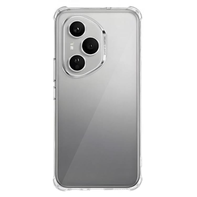 For Honor 400 Pro Global 160.8mm Kalebol 1.5mm Four-Corner Airbags Shockproof Transparency TPU Phone Case