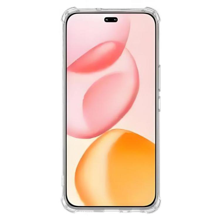 For Honor 400 Pro Global 160.8mm Kalebol 1.5mm Four-Corner Airbags Shockproof Transparency TPU Phone Case