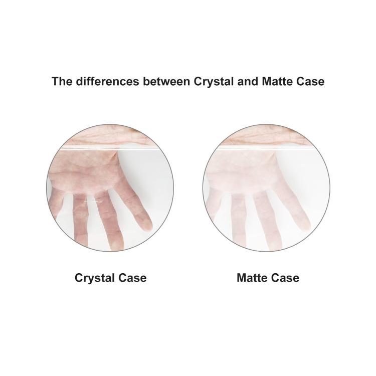 For MacBook Neo 13 inch 2026  - A3404 256G ENKAY US Version 3 in 1 Crystal Protective Case with TPU Keyboard Film & PET Screen Protector