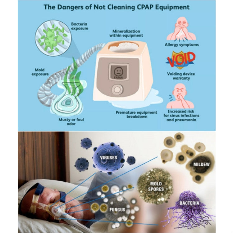 Ventilator Disinfection Treasure Ozone Sterilization Disinfection Sterilizer