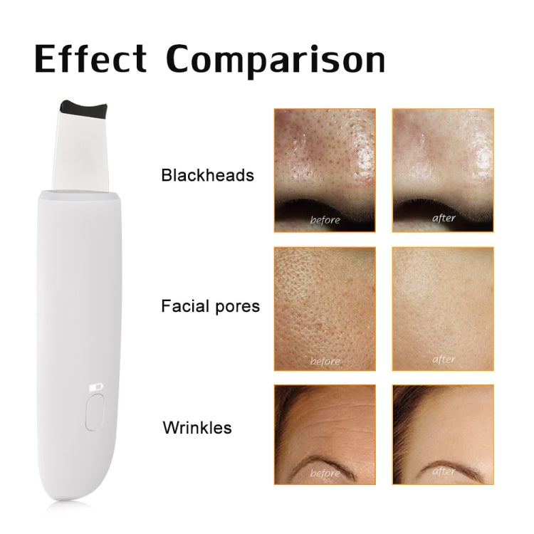 Ultrasonic Face Pore Cleanser Skin Scrubber Blackhead Acne Removal Face Exfoliator Peeling Machine Deeply Clean Skin Care Tools