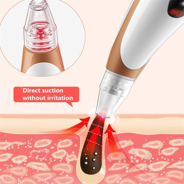 Electric Pore Cleaning Instrument Hot Compress To Export Acne Removing Blackhead Beauty Instrument