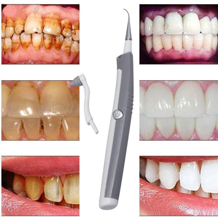 2 PCS Electric Calculus Cleaner Polishing Sonic Tooth Cleaning Vibration Tooth Cleaning Instrument(White)