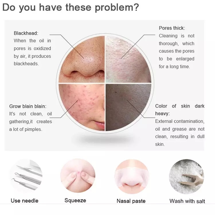 Blackhead Remover Pore Deep Cleaner Vacuum Acne Pimple Removal Vacuum Face Beauty Skin Care Tool Dermabrasion Machine