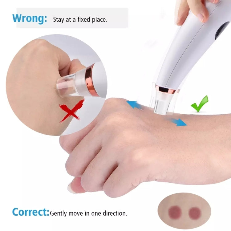 Blackhead Remover Pore Deep Cleaner Vacuum Acne Pimple Removal Vacuum Face Beauty Skin Care Tool Dermabrasion Machine