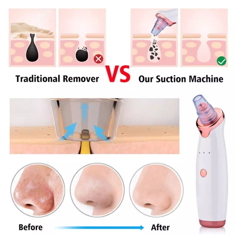 Blackhead Remover Skin Care Pore Vacuum Acne Pimple Removal Vacuum Suction Tool Facial Diamond Dermabrasion Machine Face Clean