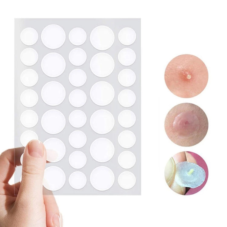 3 PCS Acne Tool Set Treatment Acne Scar  Pimples Sticker