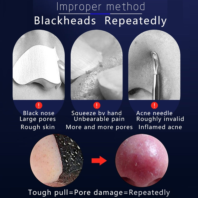 Blackhead Suction Instrument Household Pore Cleaner Beauty Instrument