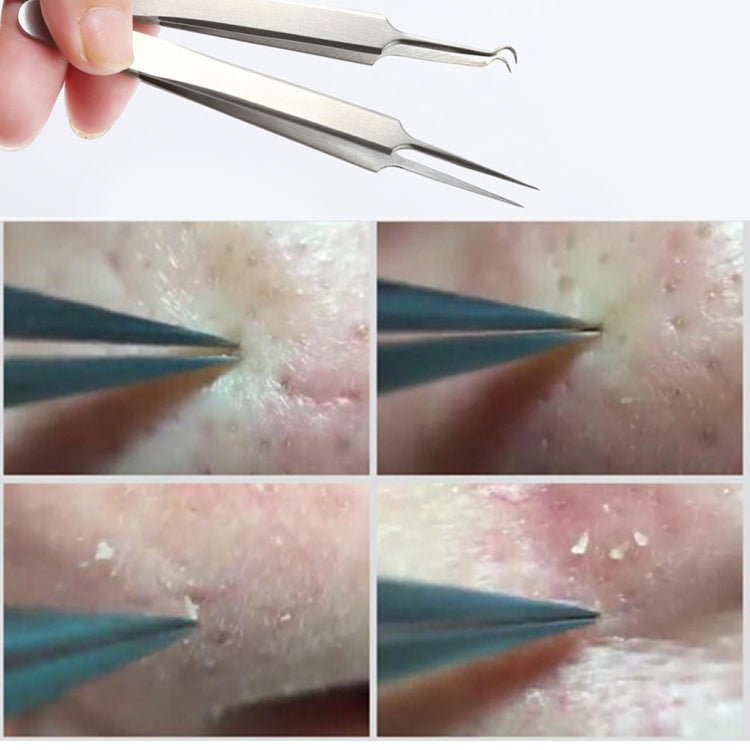 Stainless Steel Straight Bend Curved Blackhead Acne Clip Tweezer Pimple Remover(Curved Clip)