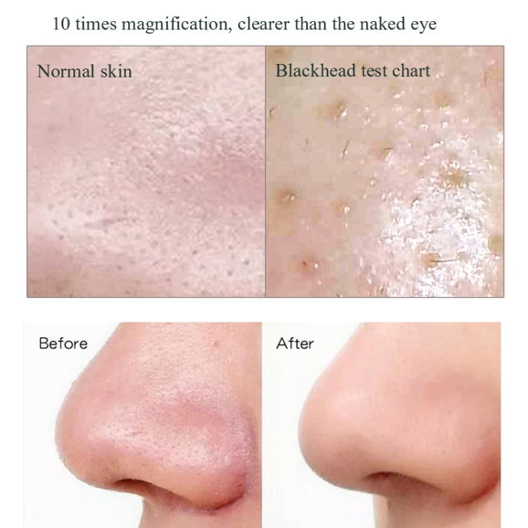 Blackhead Electric Pore Removal Machine Clean Facial Equipment,Style: Without Base