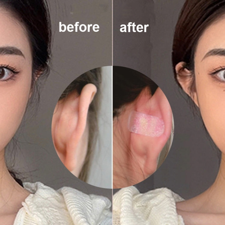 150 PCS Elf Ear Stickers Ear Correction Vertical Ear Stickers(Transparent 40x16mm)