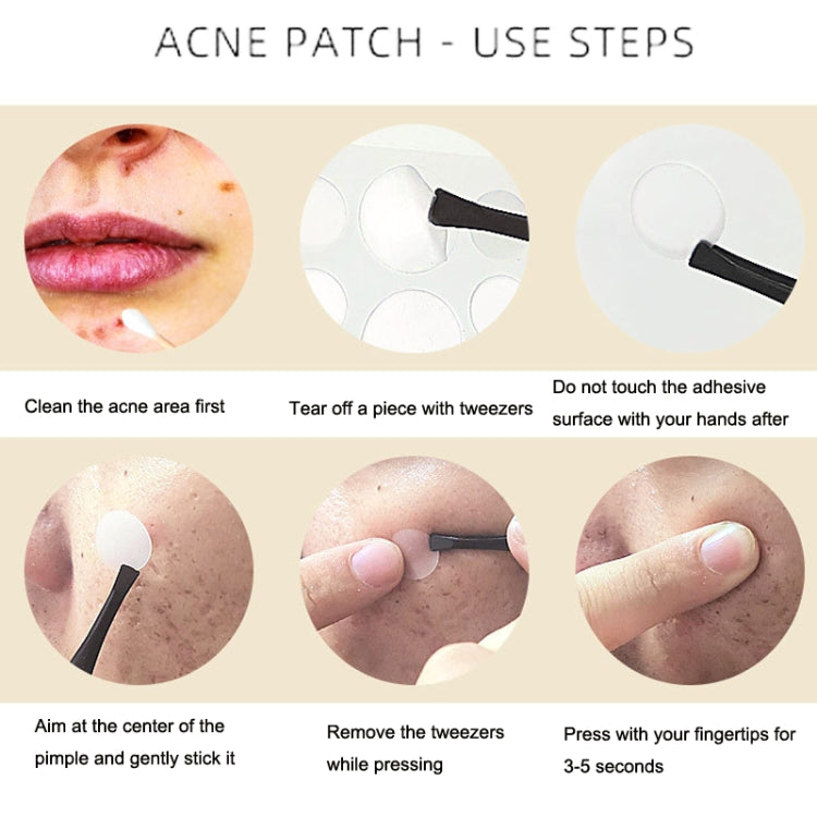 10 Sets Breathable Acne Patch Concealer Invisible Sticker(Transparent)