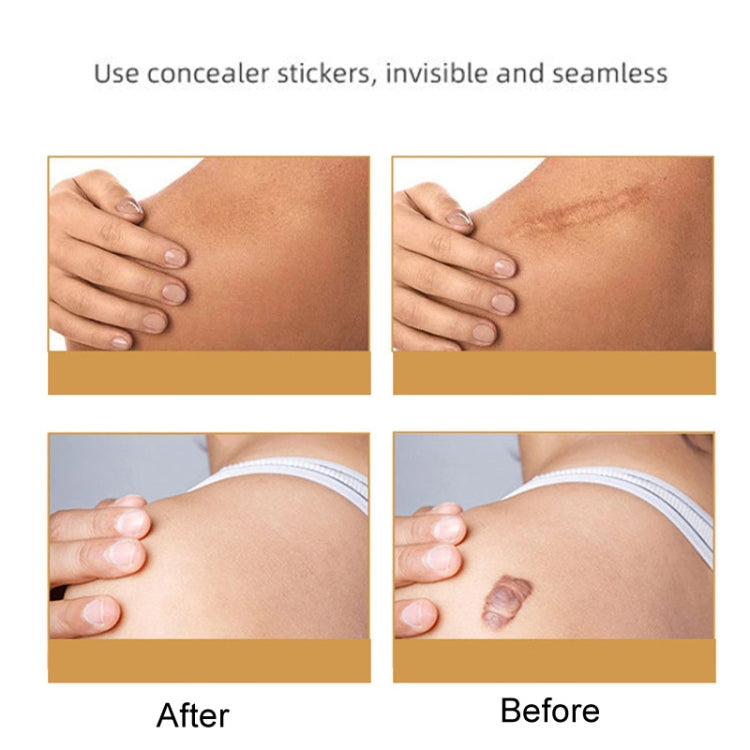 Silicone Skin Scar Invisible Self-Adhesive Cover Stickers Tattoo Acne Pits Breathable Waterproof Cuttable Concealer Stickers, Color: Skin Color 4x100cm