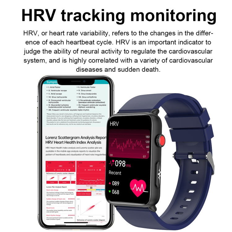 Smart Watch Ring ECG Temperature Heart Rate Blood Pressure Health Bluetooth Talking Watch, Color: Blue Silicone