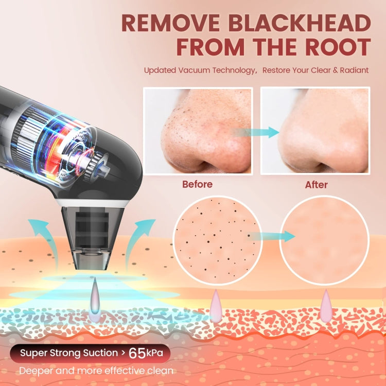 Electric Beauty Instrument Face Pore Remover Blackhead Acne Cleaner - Black