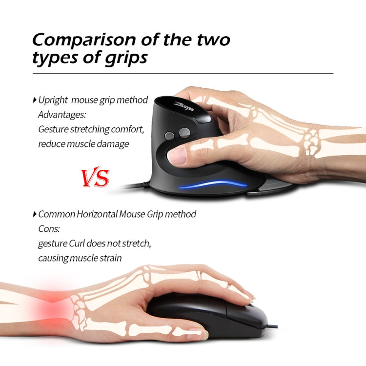 ZELOTES T30 6-keys Vertical Grip Detachable Ergonomic Wired Mouse - 7-color Breathing Light