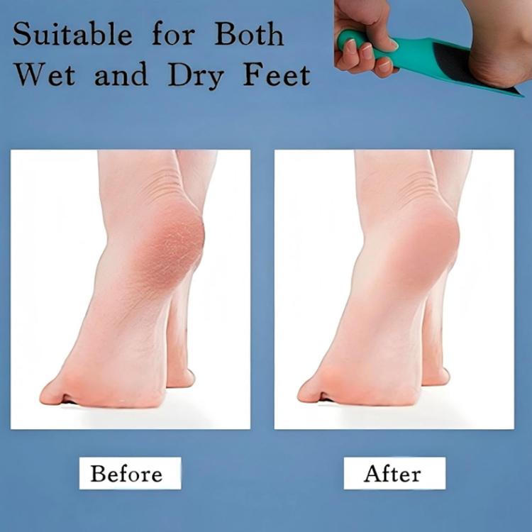 U-shaped Foot File For Removing Dead Skin, Calluses