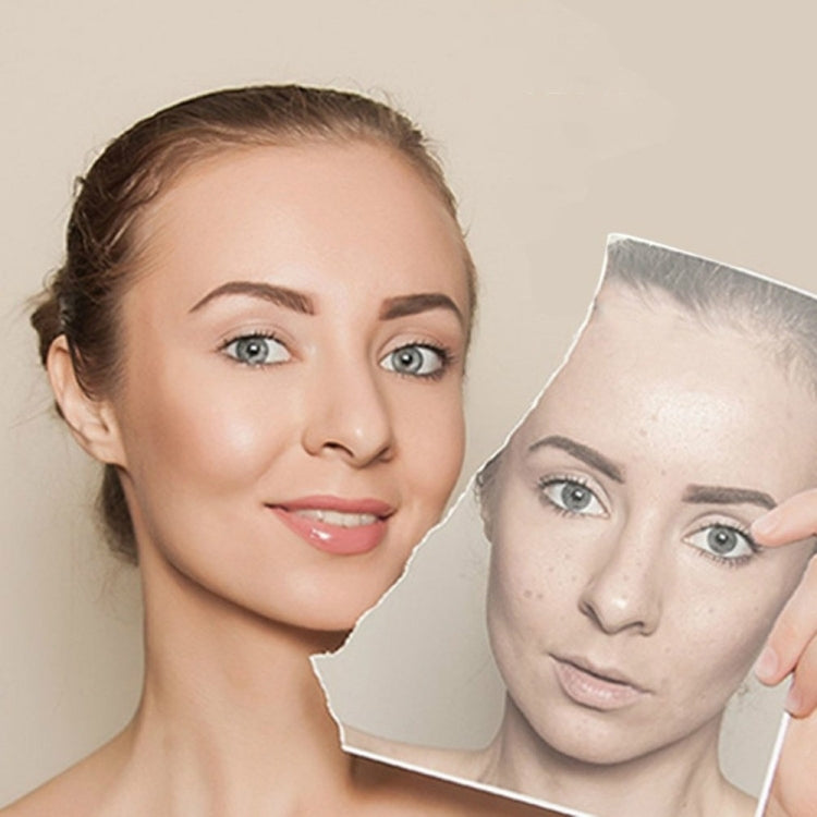 Professional Ultrasonic Ladies Skin Care Whitening Freckle Beauty Facial Machine