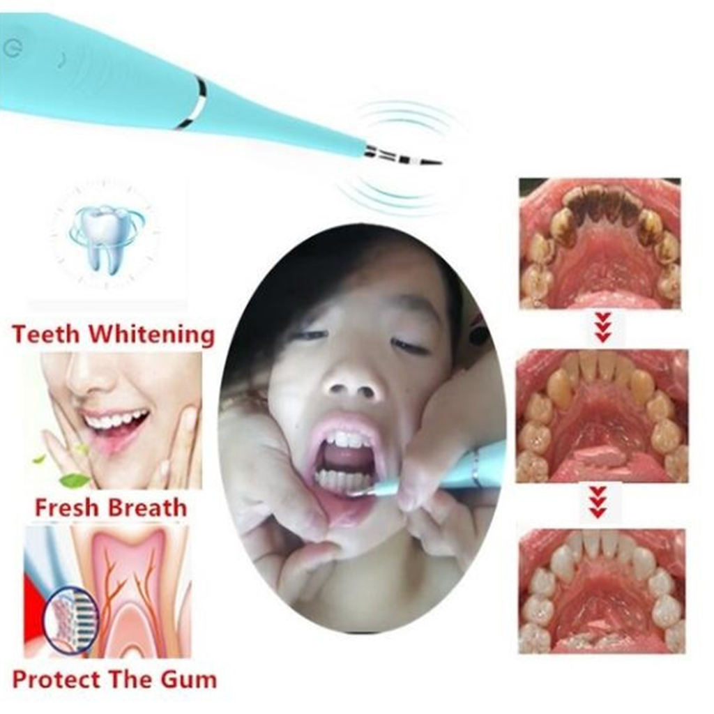 Lots 2 Electric Tooth Cleaner Dental Calculus Plaque Remover Teeth Whiten