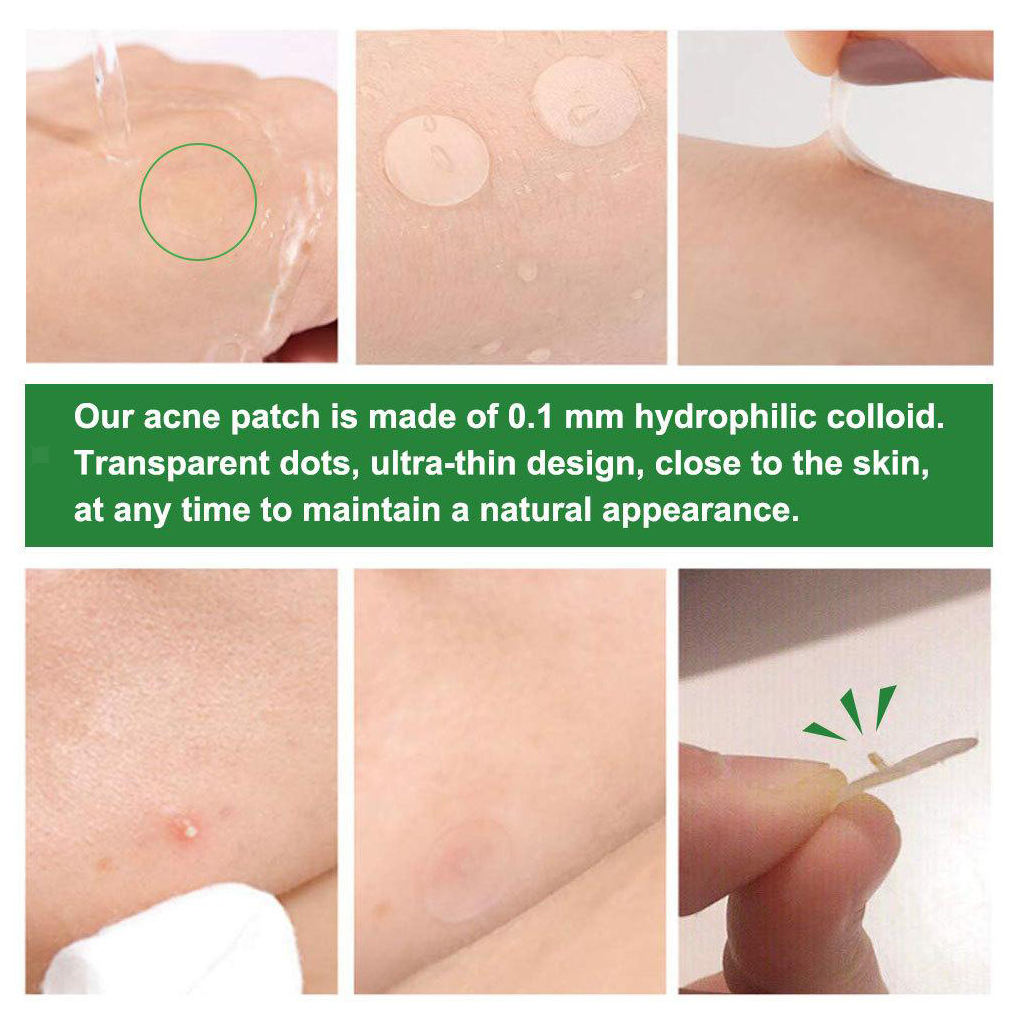 24Pcs Hydrocolloid Acne Stickers Clear Invisible Facial Spot Face Skin Care
