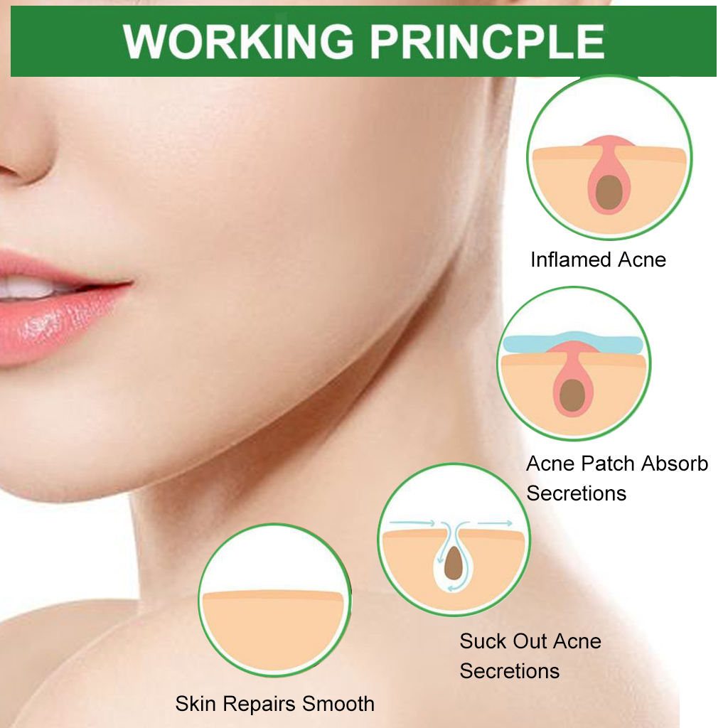 24Pcs Hydrocolloid Acne Stickers Clear Invisible Facial Spot Face Skin Care