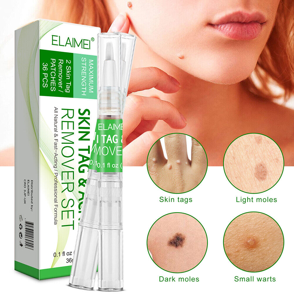 Portable Skin Tag Remover Pen Patch Wart Remove Acne Mole Treatment Tool