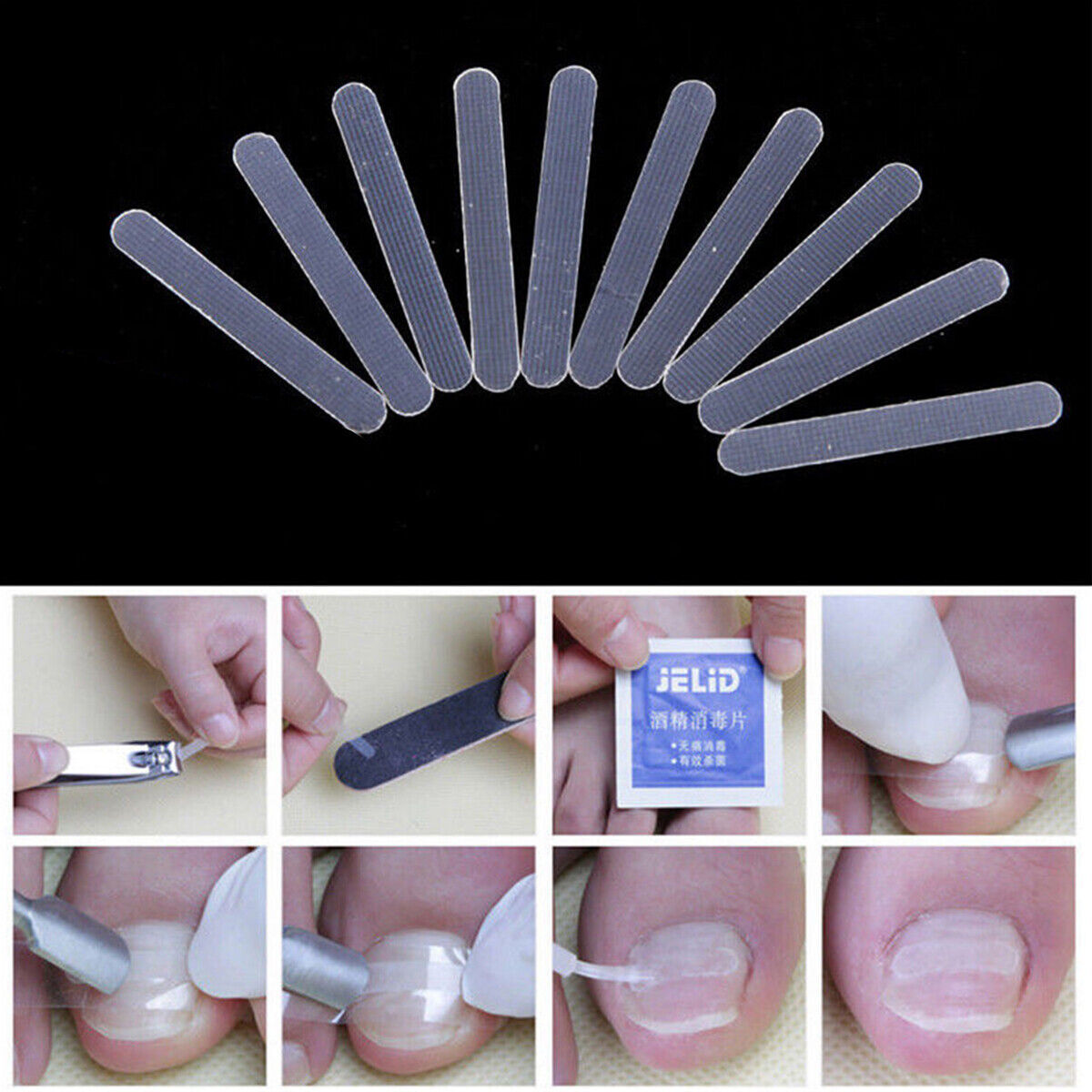 10pcs  Ingrown Toenail Straightening Clip Curved Brace Treatment Tool With Glue