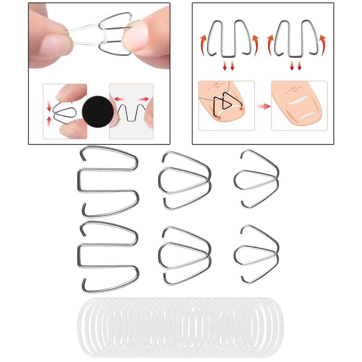 6Pcs Ingrown Toe Nail Correction Wire Paronychia Recovery Relieve Foot Pressure