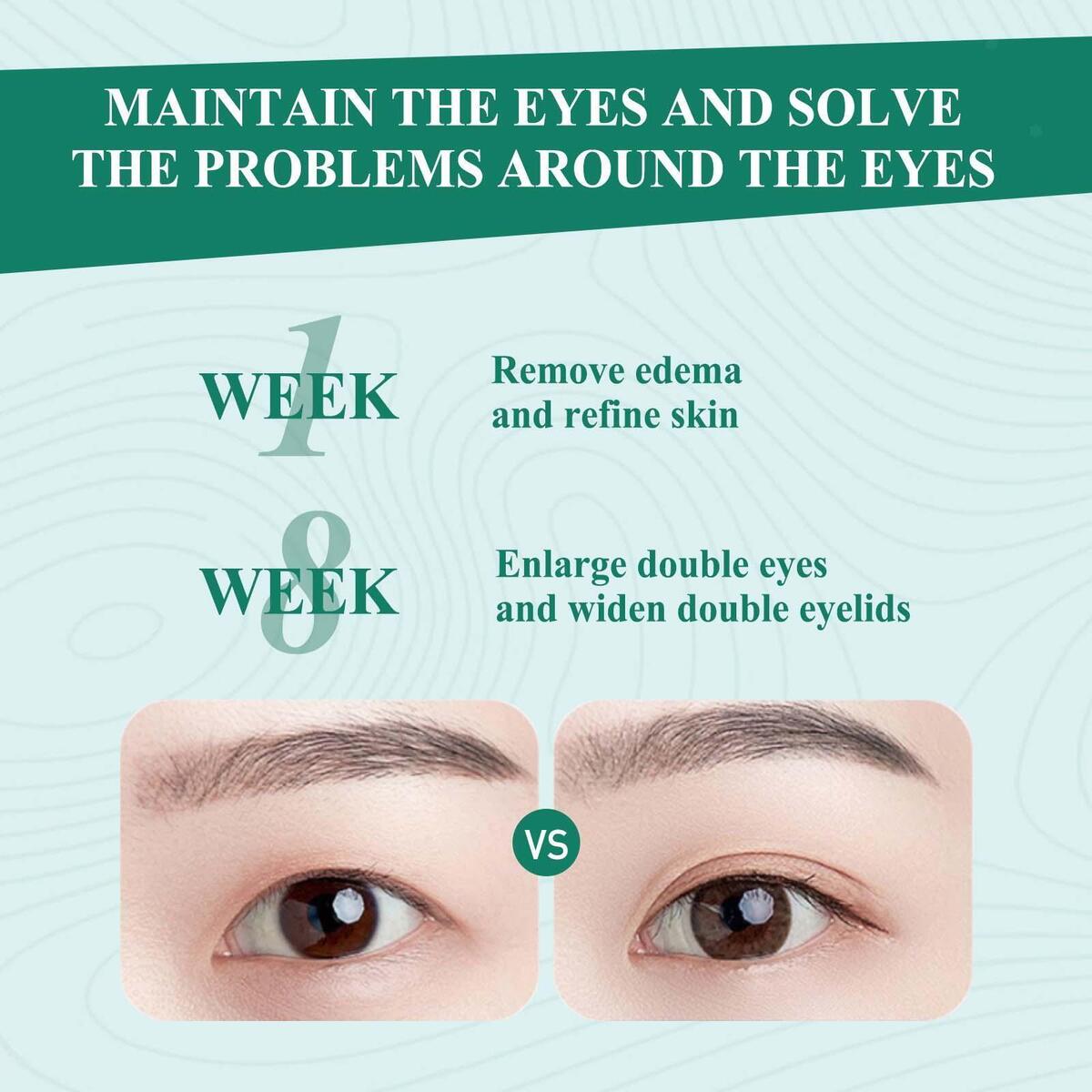 Eye Care Essence Oil Anti Swelling Double Eyelids Styling Shaping Firming