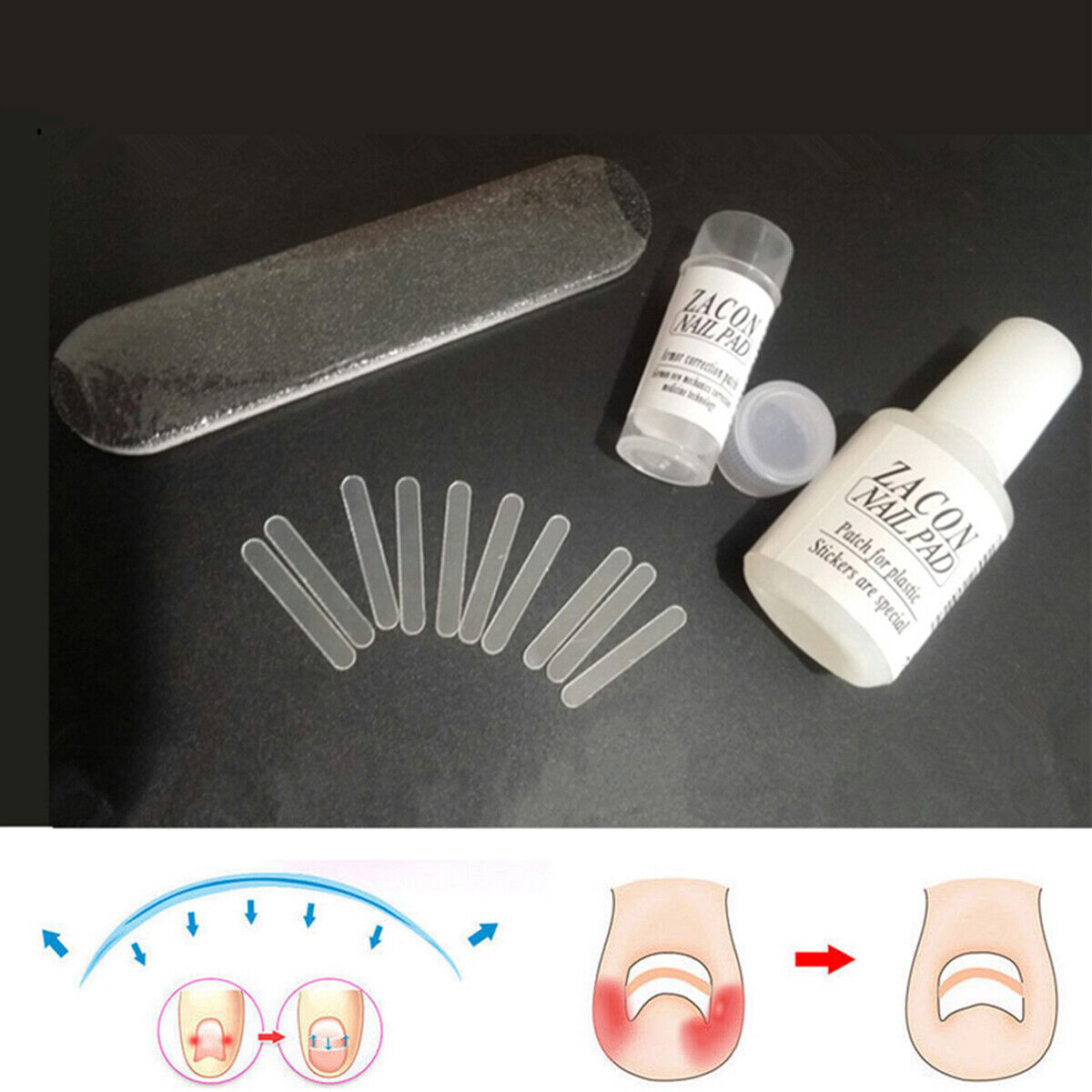 10pcs  Ingrown Toenail Straightening Clip Curved Brace Treatment Tool With Glue