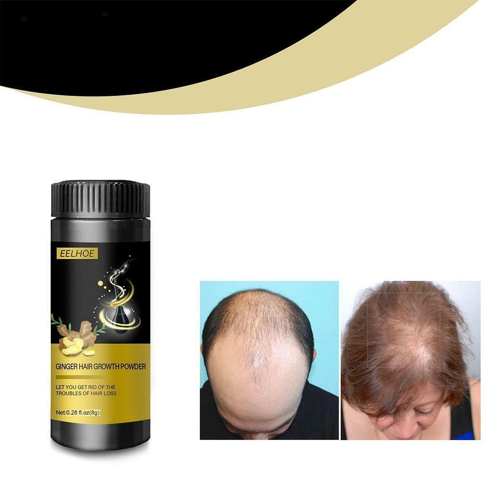Ginger Hair Growth Powder Repair Treatment Natural Formula Mild Formula Tools