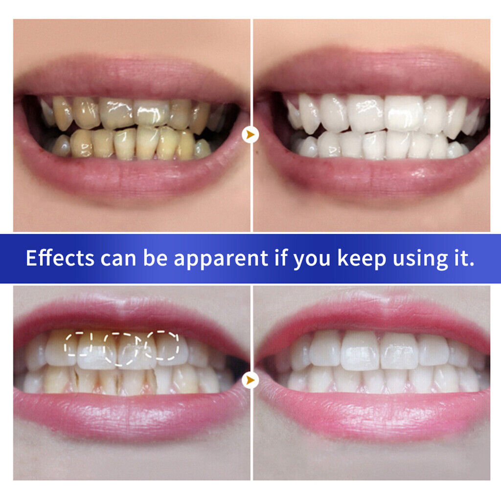 Teeth Whitening Powder Polish Supply Oral Remover Plaque Stains Dental Care Tool