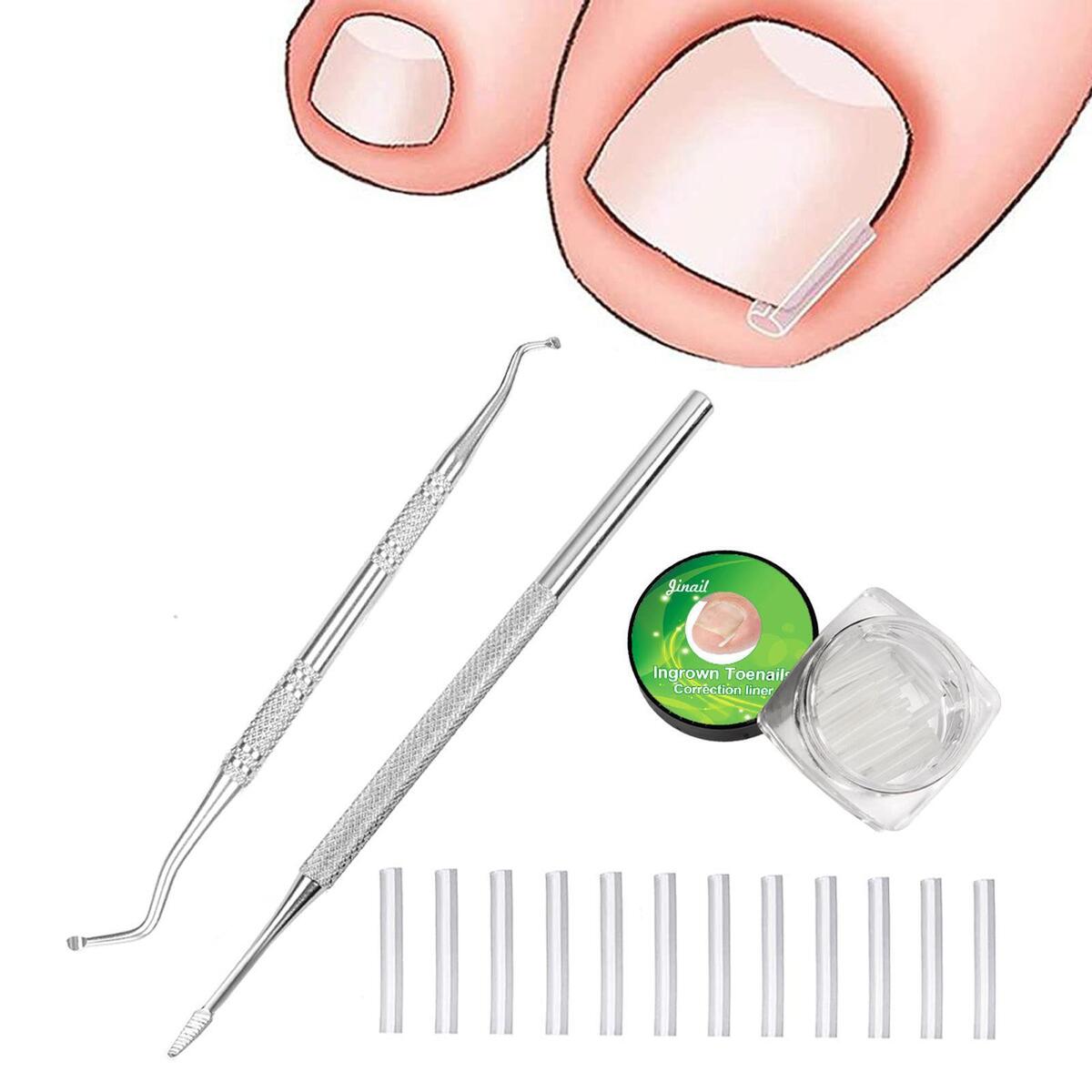 50Pcs Ingrown Toenail Corrector Strips Thick Paronychia Pedicure Tool Brace Nail