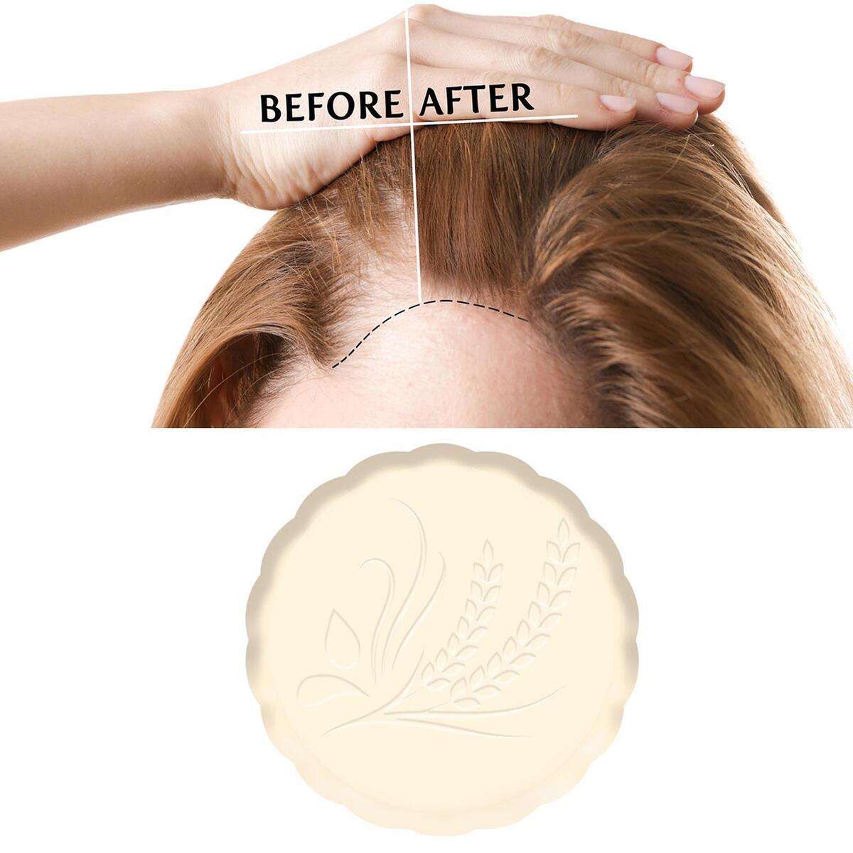 2 Pcs Rice Shampoo Bar Moisturizing Nourishhair Anti Hair Loss, for Women