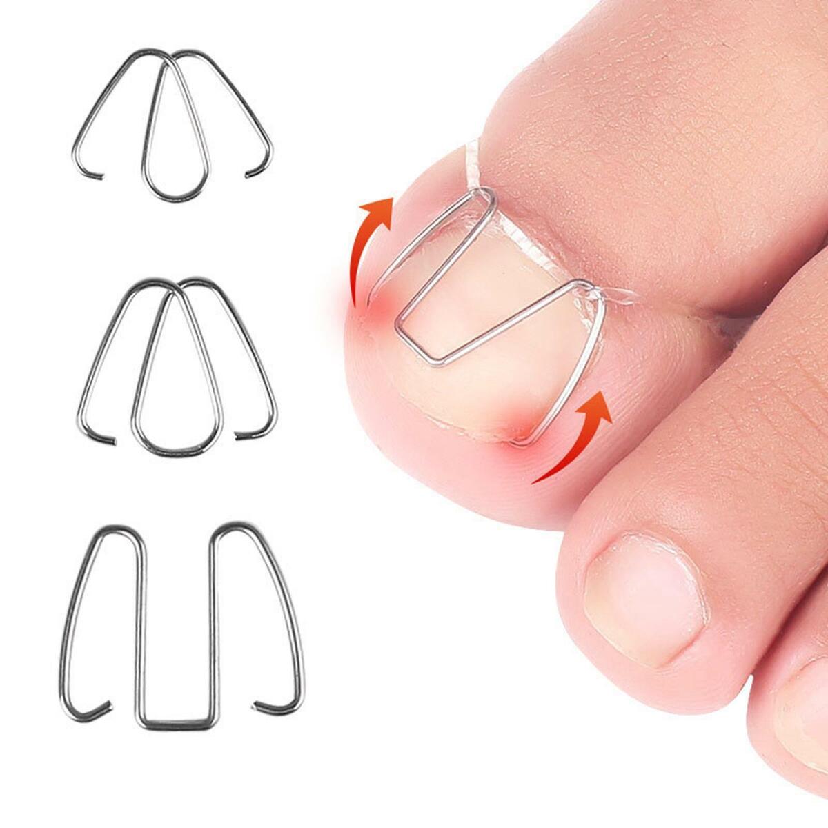 6x Ingrown Toenail Corrector Wire Relieve  Nail Correction Hook