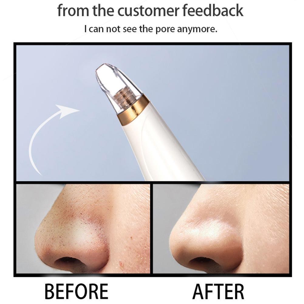 Electric Blackhead Remover Face Pimple Pore Acne Removal Skin Care Device