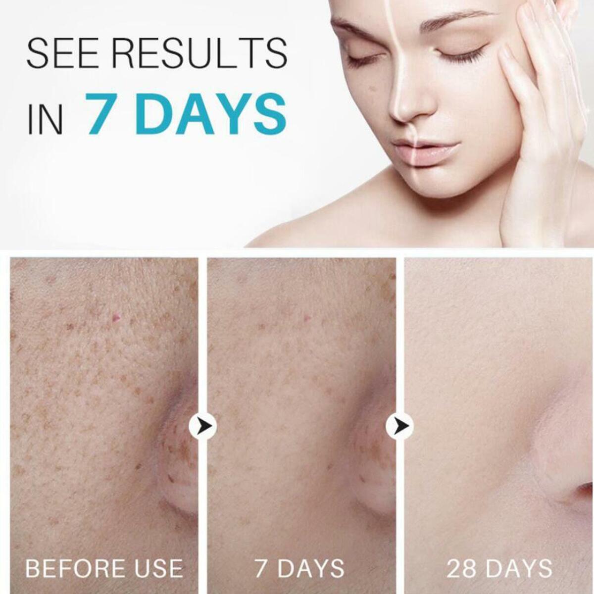 Dark   Freckles Corrector 30g, Soothes Nourishes Skin