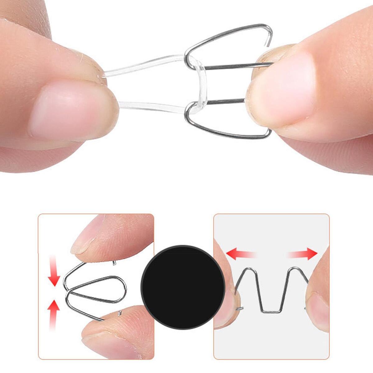6Pcs Ingrown Toe Nail Correction Wire Paronychia Recovery Relieve Foot Pressure